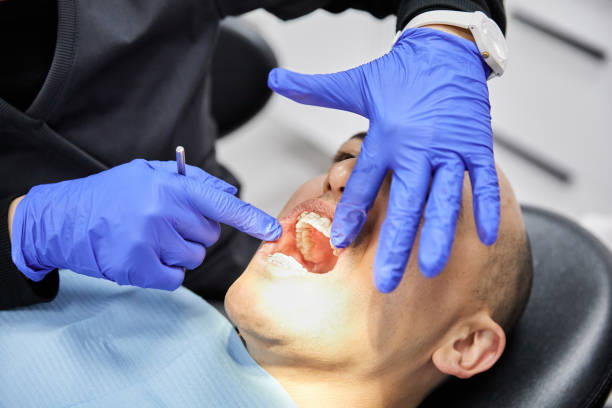 Best Tooth Infection Emergency Dentist  in Covelo, CA